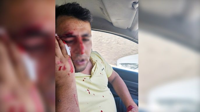 Cizre’de Kaçak Elektrik Kontrolüne Şiddetli Müdahale: 3 Saldırgandan 2’si Tutuklandı