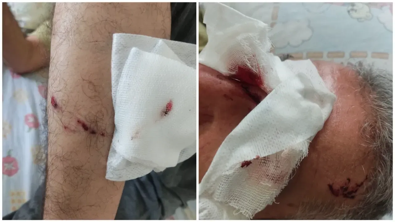 Şanlıurfa’da Köpek Saldırısı: İki Kişi Yaralandı