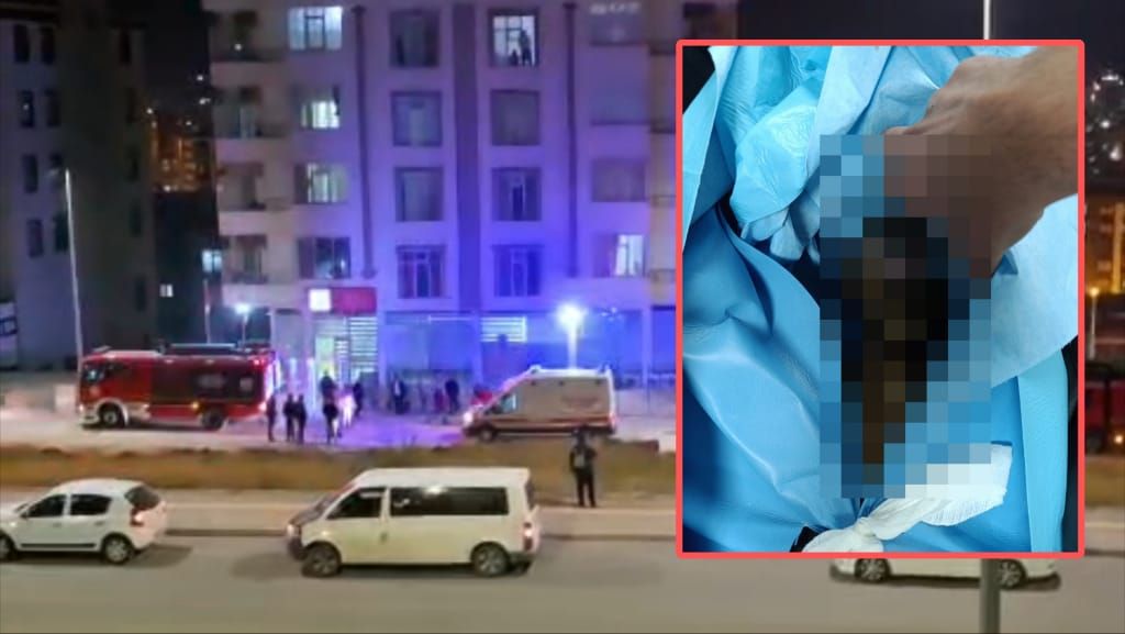 Şanlıurfa’da Çocuk Yangında Ağır Yaralandı: “İhmal” İddiası