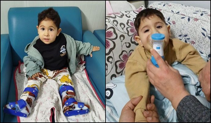 28 Aylık Umut Can SMA ile Mücadele Ediyor