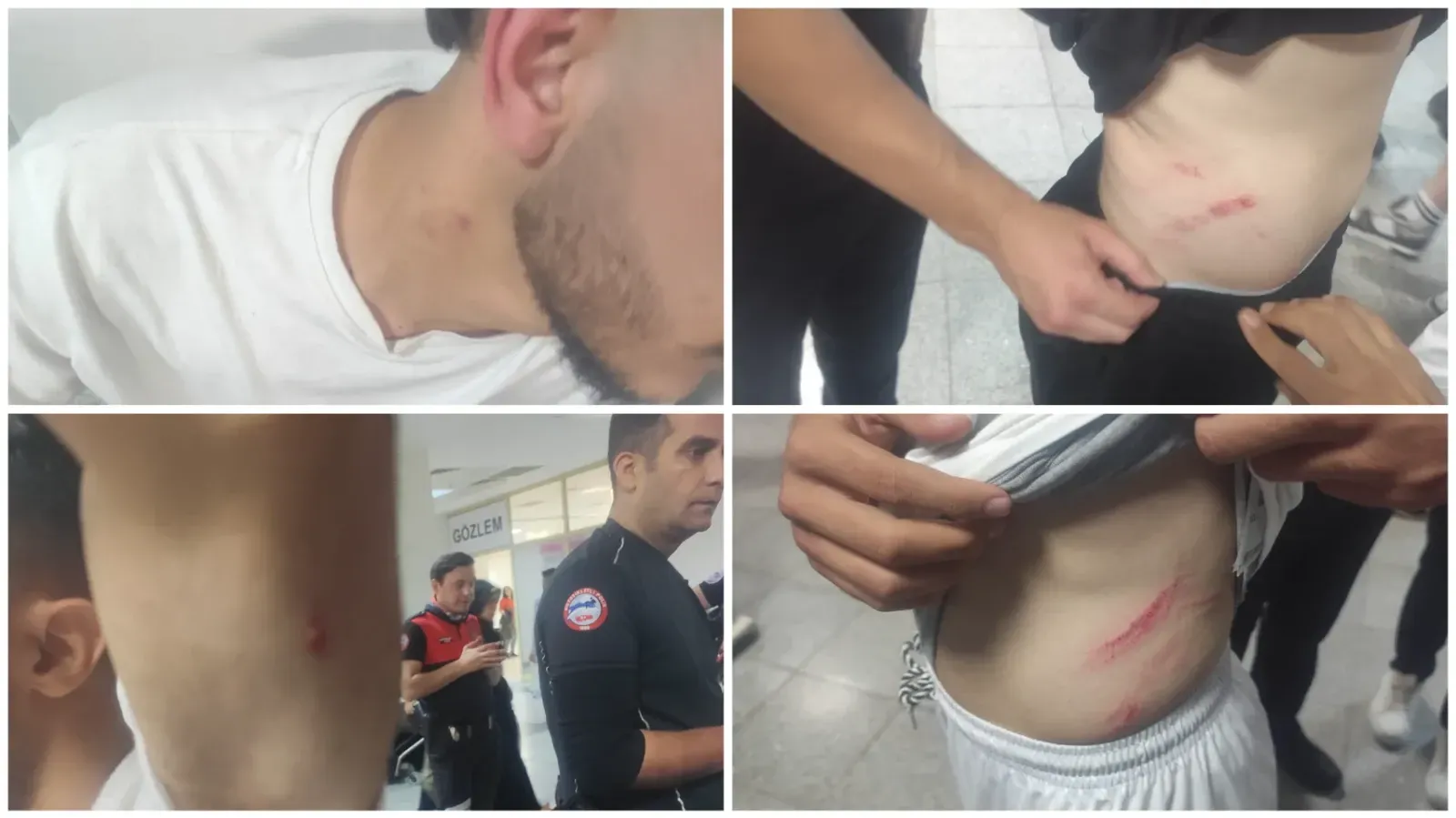 Siverek’te Amatör Maçta Bıçaklı Saldırı İddiası: 6 Futbolcu Darp Raporu Aldı