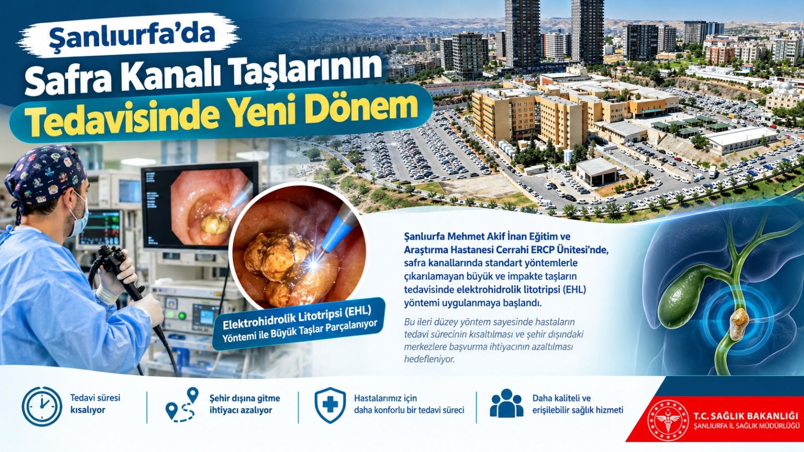 Şanlıurfa’da safra kanalı taşlarının tedavisinde EHL yöntemi uygulanmaya başlandı